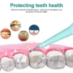 Portable Ultrasonic Tooth Cleaner - Image 6